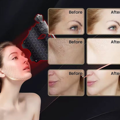 Lumora - 7 Color LED Therapy Mask